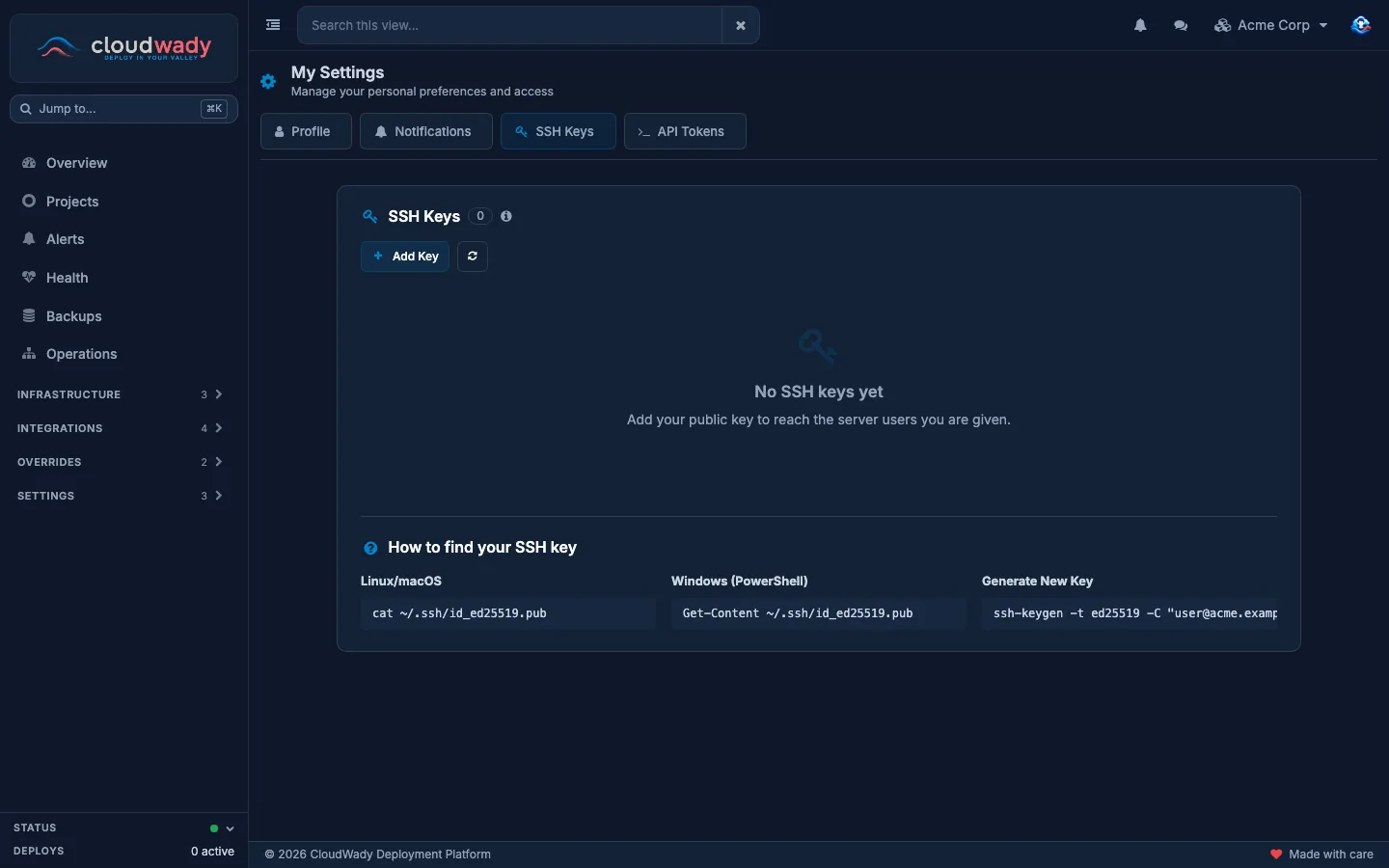 My Settings, SSH Keys, with Add Key and how to find your key
